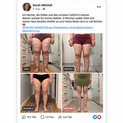 MRESIO® ✨Micro-RF-Gerät zur Körperkonturierung & Lymphdrainage🪴