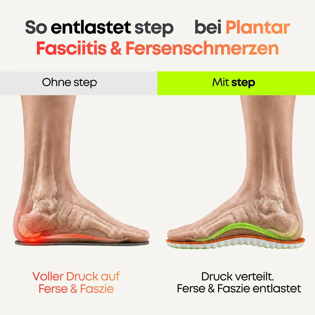 Entlastungssohlen bei Fersenschmerzen & Plantarfasziitis