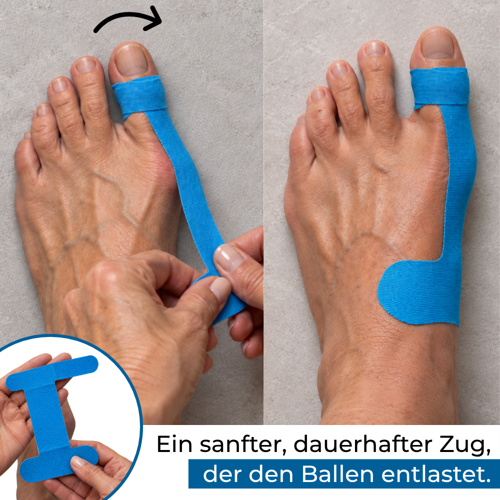 Hallux-valgus-Bandage