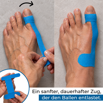 Hallux-valgus-Bandage